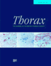 Thorax: 54 (7)