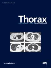 Thorax: 70 (3)