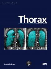 Thorax: 74 (11)